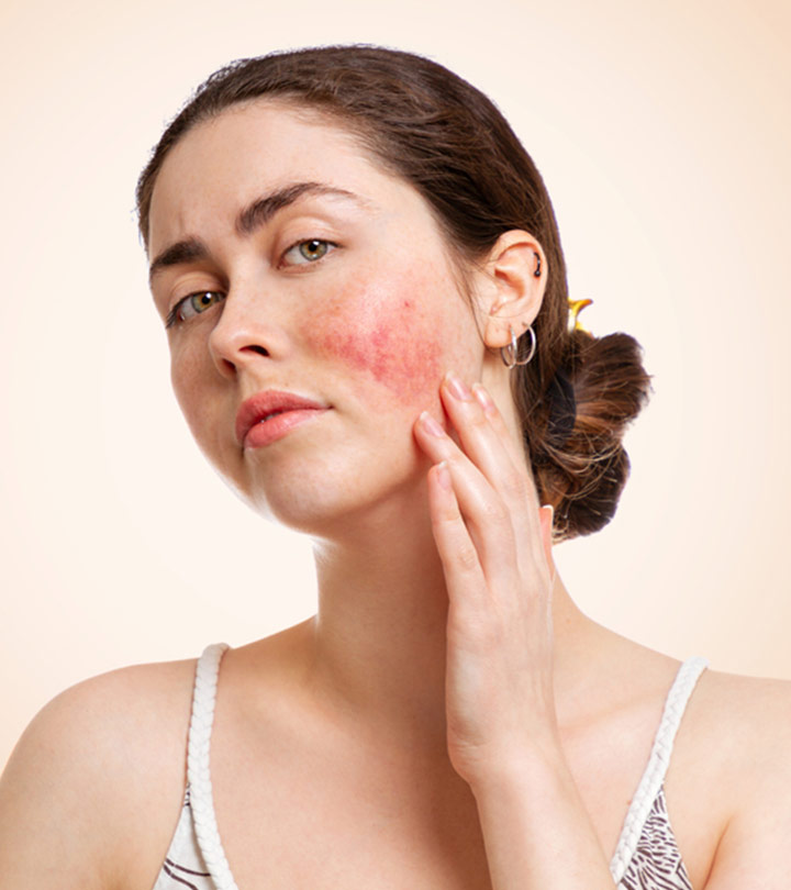 Remedies for Skin Inflammation
